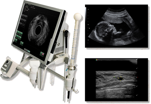 Ultrasound Ultrasound}